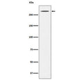 Western blot testing of mouse thyroid lysate with Thyroglobulin antibody. Predicted molecular weight ~305 kDa.