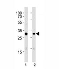 Western blot analysis of lysate from (1) A431 and (2) SK-BR-3 cell line using CDK1 antibody at 1:1000. Predicted molecular weight: ~33 kDa.
