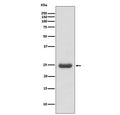 Western blot testing of human Molt4 cell lysate with TK1 antibody. Predicted molecular weight ~25 kDa.