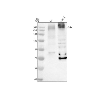 Western blot analysis of SETX using anti-SETX antibody. Electrophoresis was performed on a 8% SDS-PAGE gel at 80V (Stacking gel) / 120V (Resolving gel) for 2 hours. Lane 1: rat L6 whole cell lysates, Lane 2: mouse C2C12 whole cell lysates. After electrophoresis, proteins were transferred to a nitrocellulose membrane at 150 mA for 50-90 min. Blocked the membrane with 5% non-fat milk/TBS for 1.5 hour at RT.