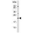 Western blot testing of human MCF7 cell lysate with Adrenomedullin antibody.