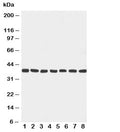 Western blot testing with Mek6 antibody and rat samples: 1. ovary; 2. spleen; 3. brain; 4. heart; 5. mouse NIH3T3; and human samples 6. HeLa; 7. Jurkat; 8. MCF-7 cell lysate. Predicted molecular weight ~37 kDa.