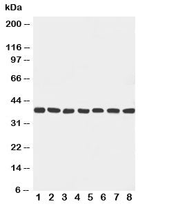 Western blot testing with Mek6 antibody and rat samples: 1. ovary; 2. spleen; 3. brain; 4. heart; 5. mouse NIH3T3; and human samples 6. HeLa; 7. Jurkat; 8. MCF-7 cell lysate. Predicted molecular weight ~37 kDa.