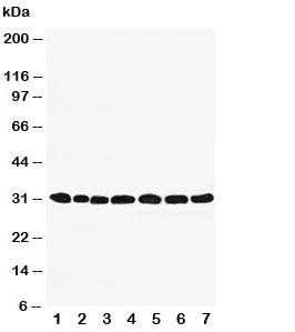 Western blot testing of Peroxiredoxin 4 antibody and Lane 1: rat brain; 2: (r) lung; 3: (r) liver; 4: (r) kidney; 5: human HeLa; 6: (h) 293T; 7: (h) MCF-7 cell lysate. Expected size: ~31KD