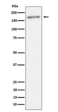 Western blot analysis of Phospho-ErbB2(Y1221 + Y1222) expression in human SKBR3 cell lysate using Phospho-ErbB2 (Tyr1221/Tyr1222) antibody. A single band is detected at approximately 190â€“200 kDa, consistent with the phosphorylated, full-length form of the ErbB2/HER2 receptor.