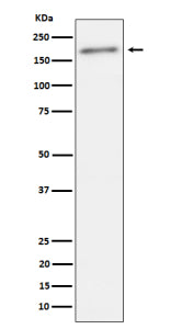 Western blot analysis of Phospho-ErbB2(Y1221 + Y1222) expression in human SKBR3 cell lysate using Phospho-ErbB2 (Tyr1221/Tyr1222) antibody. A single band is detected at approximately 190â€“200 kDa, consistent with the phosphorylated, full-length form of the ErbB2/HER2 receptor.