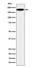 Western blot analysis of IQGAP2 expression in HepG2 cell lysate using IQGAP2 antibody. Predicted molecular weight ~181 kDa.