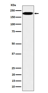 Western blot analysis of IQGAP2 expression in HepG2 cell lysate using IQGAP2 antibody. Predicted molecular weight ~181 kDa.