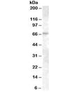 Western blot testing of A431 lysate with ABCE1 antibody at 0.3ug/ml. Predicted molecular weight: ~68kDa.