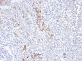 IHC staining of FFPE human tonsil with recombinant CD38 antibody. HIER: boil tissue sections in pH 9 10mM Tris with 1mM EDTA for 20 min and allow to cool before testing.