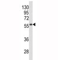 Western blot analysis of Beclin1 antibody and mouse stomach tissue lysate.