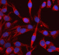 Immunofluorescent staining of RIG using anti-RIG antibody (red). RIG was detected in an immunocytochemical section of HELA cells. Enzyme antigen retrieval was performed using IHC enzyme antigen retrieval reagent for 15 mins. The cells were blocked with 10% goat serum. And then incubated with 5 ug/ml rabbit anti-DKK3 antibody overnight at 4oC. Cy3 Conjugated Goat Anti-Rabbit IgG was used as secondary antibody at 1:500 dilution and incubated for 30 min at 37oC.
