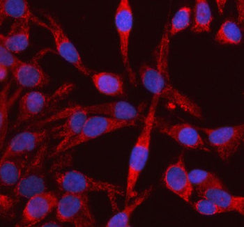 Immunofluorescent staining of RIG using anti-RIG antibody (red). RIG was detected in an immunocytochemical section of HELA cells. Enzyme antigen retrieval was performed using IHC enzyme antigen retrieval reagent for 15 mins. The cells were blocked with 10% goat serum. And then incubated with 5 ug/ml rabbit anti-DKK3 antibody overnight at 4oC. Cy3 Conjugated Goat Anti-Rabbit IgG was used as secondary antibody at 1:500 dilution and incubated for 30 min at 37oC.