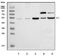 Western blot testing of 1) mouse kidney, 2) mouse skeletal muscle, 3) mouse heart, 4) rat heart and 5) rat kidney lysate with Slc14a1 antibody. Predicted molecular weight: 42-54 kDa depending on glycosylation level.