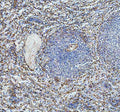 IHC staining of FFPE human spleen tissue with P-Selectin antibody, HRP-labeled secondary and DAB substrate. HIER: boil tissue sections in pH8 EDTA for 20 min and allow to cool before testing.