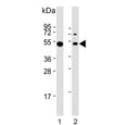 Western blot testing of human 1) Daudi and 2) Ramos cell lysate with Lymphocyte Specific Protein 1 antibody. Predicted molecular weight: ~37 kDa but is routinely observed at ~52 kDa (PMID: 15684321).