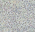 IHC staining of FFPE mouse liver tissue with DCK antibody. HIER: boil tissue sections in pH8 EDTA for 20 min and allow to cool before testing.
