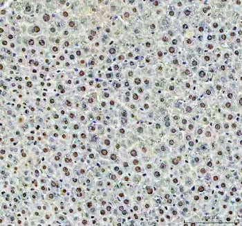 IHC staining of FFPE mouse liver tissue with DCK antibody. HIER: boil tissue sections in pH8 EDTA for 20 min and allow to cool before testing.