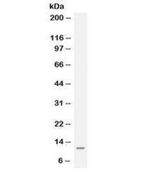 Western blot testing of human Jurkat cell lysate with MGP antibody. Expected molecular weight ~10 kDa.