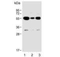 Western blot testing of human 1) U-87 MG, 2) MDA-MB-231 and 3) U-251 MG cell lysate with USP17L24 antibody. Predicted molecular weight ~60 kDa.