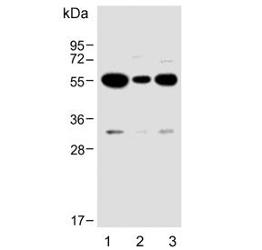 Western blot testing of human 1) U-87 MG, 2) MDA-MB-231 and 3) U-251 MG cell lysate with USP17L24 antibody. Predicted molecular weight ~60 kDa.