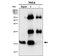 Immunoprecipitation of UBE2D1 protein from 500ug of human HeLa whole cell lysate using UBE2D1 antibody at 1:50.