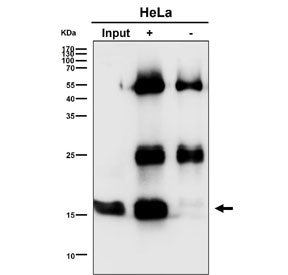 Immunoprecipitation of UBE2D1 protein from 500ug of human HeLa whole cell lysate using UBE2D1 antibody at 1:50.