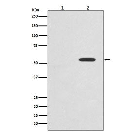 Western blot testing of lysate from 1) untreated and 2) Calyculin A and Okadaic Acid-treated human HeLa cells with phospho-c-Myc antibody. Theoretical molecular weight: ~50 kDa but routinely observed at 50~70 kDa.