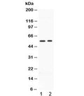 Western blot testing of human 1) HeLa and 2) MCF7 cell lysate with BMP15 antibody at 0.5ug/ml. Routinely observed molecular weight: ~50 kDa pro form and 16-17 kDa mature form.