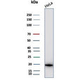 Western blot testing of human HeLa cell lysate with Crystallin Alpha B antibody (clone CRYAB/4659). Predicted molecular weight ~20 kDa.