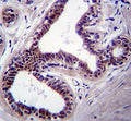 JNK1 antibody immunohsitochemistry analysis in formalin fixed and paraffin embedded human breast tissue.