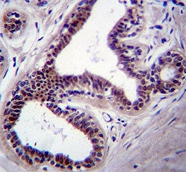 JNK1 antibody immunohsitochemistry analysis in formalin fixed and paraffin embedded human breast tissue.