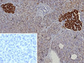IHC staining of FFPE human pancreas tissue with recombinant CgA antibody (clone rCHGA/9612). Inset: PBS used in place of primary Ab (secondary Ab negative control). HIER: boil tissue sections in pH 9 10mM Tris with 1mM EDTA for 20 min and allow to cool before testing.