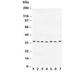 Western blot testing of Cyclin D1 antibody and Lane 1: rat testis; 2: human placenta; 3: rat brain; 4: MCF-7; 5: COLO320; 6: SW620; 7: MM231. Predicted molecular weight: 32-36 kDa.
