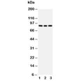 Western blot testing of PI3K antibody and Lane 1: rat testis; 2: 293T; 3: HeLa cell lysate. Predicted molecular weight ~85 kDa.