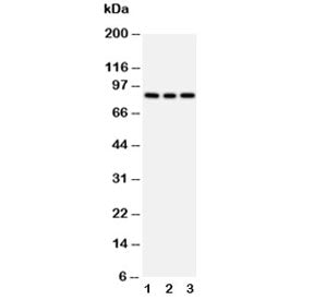 Western blot testing of PI3K antibody and Lane 1: rat testis; 2: 293T; 3: HeLa cell lysate. Predicted molecular weight ~85 kDa.