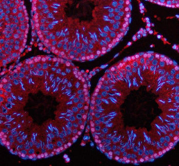 Immunofluorescent staining of PDZD8 using anti-PDZD8 antibody (red). PDZD8 was detected in a paraffin-embedded section of rat testis tissue. Heat mediated antigen retrieval was performed in EDTA buffer (pH 8.0, epitope retrieval solution). The tissue section was blocked with 10% goat serum. The tissue section was then incubated with 5 ug/ml rabbit anti-PDZD8 antibody overnight at 4oC. Cy3 Conjugated Goat Anti-Rabbit IgG was used as secondary antibody at 1:500 dilution and incubated for 30 min at 37oC.