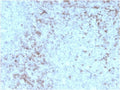 IHC staining of FFPE human spleen with recombinant CD3e antibody (clone rC3e/1931). HIER: boil tissue sections in pH 9 10mM Tris with 1mM EDTA for 10-20 min and allow to cool before testing.