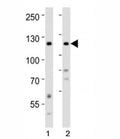 Western blot analysis of lysate from 1) human HeLa and 2) human SH-SY5Y cell line using Ror2 antibody at 1:1000.