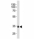 Western blot analysis of lysate from human plasma tissue lysate using ApoE antibody diluted at 1:1000. Predicted molecular weight: 34-37 kDa