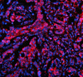 Immunofluorescent staining of MTMR3 using anti-MTMR3 antibody (green) and anti-Beta Tubulin antibody (red). MTMR3 was detected in an immunocytochemical section of SIHA cells. Enzyme antigen retrieval was performed using IHC enzyme antigen retrieval reagent for 15 mins. The cells were blocked with 10% goat serum. And then incubated with 5 ug/ml rabbit anti-MTMR3 antibody and mouse anti-Beta Tubulin antibody overnight at 4oC.
