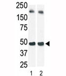 The SphK1 antibody used in western blot (lane 2) to detect c-myc-tagged SphK1 in transfected 293 cell lysate (a c-myc antibody is used as control in Lane 1). Predicted molecular weight: ~43/51/44kDa (isoforms 1/2/3).