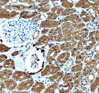 IHC staining of FFPE human kidney tissue with GLRX antibody, HRP-secondary and DAB substrate. HIER: boil tissue sections in pH8 EDTA for 20 min and allow to cool before testing.