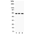 Western blot testing of RELA antibody and human samples 1: Jurkat; 2: COLO320; 3: HeLa lysate. Expected molecular weight ~65 kDa.