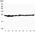 Western blot testing of 1) rat brain, 2) rat testis, 3) rat thymus, 4) mouse brain, 5) mouse testis, 6) mouse thymus, 7) human A549, 8) human 22RV1 and 9) human HeLa lysate with RAN antibody at 0.5ug/ml. Predicted molecular weight ~25 kDa.