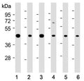 Western blot testing of human 1) A431, 2) MOLT4, 3) Jurkat, 4) PC-12, 5) mouse NIH3T3 and 6) mouse brain lysate with ASS1 antibody at 1:2000. Predicted molecular weight ~46 kDa.