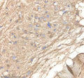 IHC staining of zebrafish Ppm1g protein using Zebrafish Ppm1g antibody, HRP-labeled secondary and DAB substrate. Ppm1g was detected in a paraffin-embedded section of zebrafish brain tissue. HIER: boil tissue sections in pH8 EDTA for 20 min and allow to cool before testing.