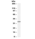 Western blot testing of HepG2 cell lysate with MRPL3 antibody at 1ug/ml. Predicted molecular weight: ~38kDa.