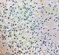 Immunohistochemical staining of NUP93 using anti-NUP93 antibody. NUP93 was detected in a paraffin-embedded section of mouse brain tissue. Heat mediated antigen retrieval was performed in EDTA buffer (pH 8.0, epitope retrieval solution). The tissue section was blocked with 10% goat serum. The tissue section was then incubated with 2 ug/ml rabbit anti-NUP93 antibody overnight at 4oC. Peroxidase Conjugated Goat Anti-rabbit IgG was used as secondary antibody and incubated for 30 min at 37oC.