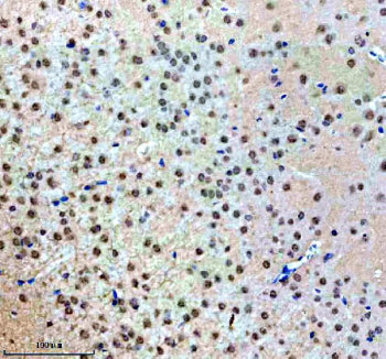 Immunohistochemical staining of NUP93 using anti-NUP93 antibody. NUP93 was detected in a paraffin-embedded section of mouse brain tissue. Heat mediated antigen retrieval was performed in EDTA buffer (pH 8.0, epitope retrieval solution). The tissue section was blocked with 10% goat serum. The tissue section was then incubated with 2 ug/ml rabbit anti-NUP93 antibody overnight at 4oC. Peroxidase Conjugated Goat Anti-rabbit IgG was used as secondary antibody and incubated for 30 min at 37oC.